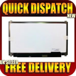 New HP Envy 13 D001LA 13.3" QHD+ eDP LCD Screen IPS Display Panel Without Touch