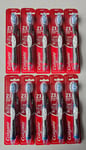 Colgate 360 Max White Expert Whitening Sonic Power Battery Toothbrush, 10 