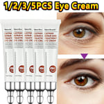 5PCS Magic Eye Cream 28 seconds to remove eye bags / dark circles / eye wrinkles