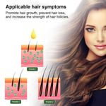 Herbal Ginger Shampoo Oil Control Dandruff Removal Shampoo Hair Loss Prev UK GGM