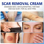 Scar Removal Cream 50ml Skin Repair Effective Stretch Mark Surgery Injury SG5