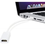 INECK® Adaptateur Mini Displayport HDMI - Cable Connecteur Mini-displayport Thunderbolt HDMI Prise pour Apple MacBook Air-Pro, Mac,
