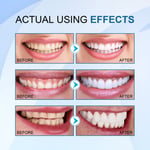 3pcs 10ml Teeth Whitening Serum Freshen Breath Stain Removal Tooth Brighten SLS