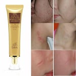 LanBeNa Ginseng Acne Treatment Scar Removal Cream Gel Stretch Cut Burn Spot Mark