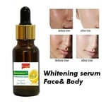 Whitening serum Face& Body whitening hyaluronic acid vit. C evterpa