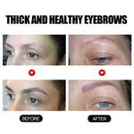2pcs Eyebrow Growth Serum Thickening Nourishing Eyebrow Growth Solution