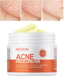 CLY AMS Acne Face Cream,Salicylic Acid Acne Clearing for Face & Body,Back but Ac