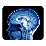 Scan Magnetic Resonance MRI of The Brain Xray Child Home School Game Player Computer Worker MouseMat Mouse Padch