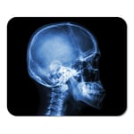 Mousepad Computer Notepad Office Blue Xray Film X Ray Skull and Cervical Spine Lateral View Brain Bone Head Skeleton Home School Game Player Computer Worker Inch