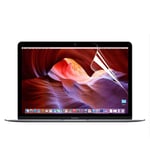 Displayskydd HD för MacBook 12-tum A1534 - Enkay