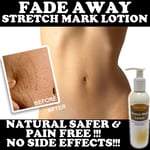 FADE AWAY STRETCH MARK LOTION CREAM MAX STRENGTH REMOVES STRETCH MARKS