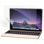 MacBook Pro 13' Retina High Transparency Skærmbeskytter