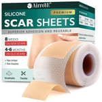 Silicone Scar Sheets,Silicone Scar Tape(1.6"X 120" Roll-3M), Reusable and Effect