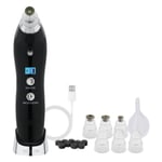 Michael Todd Beauty Sonic Refresher Wet/Dry Sonic Microdermabrasion and Pore Extraction System (Various Shades) - Black