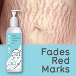NIP & TUCK BODY CORRECTIVE LOTION STRETCH MARK LOTION FADES RED MARKS LINES
