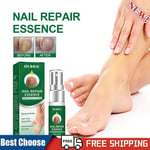 Nail Treatment Essence Professional Toe Repair Nail Fungal Removal Gel