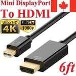 2m Mini DP Display Port to HDMI Thunder Bolt Cable Adapter For MacBook Air Pro