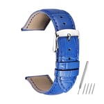 MKXF Crocodile Pattern Genuine Cow Leather Strap Watch Band Watchband 14 16 18 19 20 21 22 24 mm Watch Strap