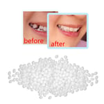 Bottled Tooth Filling Kit Temporary Teeth Tooth Repair Kit Dental Repair Kit Dental Cement 10ml/20ml/30ml (30ml)