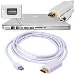 Kabalo 1.8m ThunderBolt Mini DisplayPort DP to HDMI Adapter Male-to-Male Cable For Macbook Pro Air M/M (White)