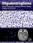 Academic Press Inc Nina A. Paleologos (Edited by) Oligodendroglioma: Clinical Presentation, Pathology, Molecular Biology, Imaging, and Treatment