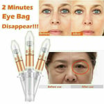UK Magic Eye Cream 2 Minutes Instant Remove Eyebags Firming Eye Anti Puffiness~