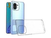 Mocco Ultra Back Case 0.3 Mm Silicone Case For Xiaomi Mi 11 5G Transparent