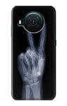 X-ray Peace Sign Fingers Case Cover For Nokia X10