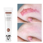 Scar Cream Non Irritating Stretch Mark Cream Removal Scars For Face Or Body Gfl