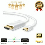 Mini DisplayPort DP to HDMI Male Thunderbolt Adapter Cable For MacBook 1080P UK